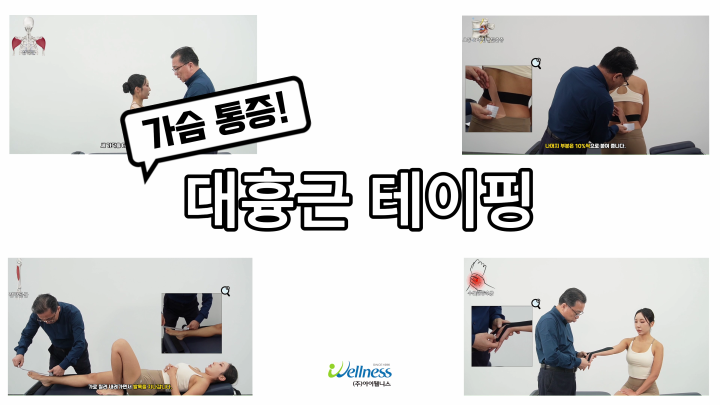가슴 통증! 대흉근 테이핑 요법