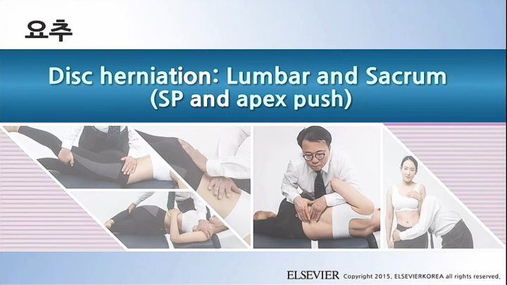 요추_043_Disc herniation; Lumbar and Sacrum (SP and ape)