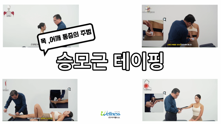 목 어깨 통증의 주범 승모근 테이핑 요법
