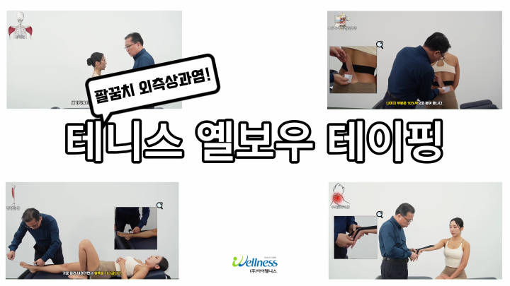 팔꿈치 외측상과염! 테니스 옐보우 테이핑 요법