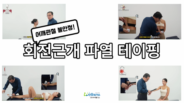 어깨관절의 불안정! 회전근개 파열 테이핑 요법