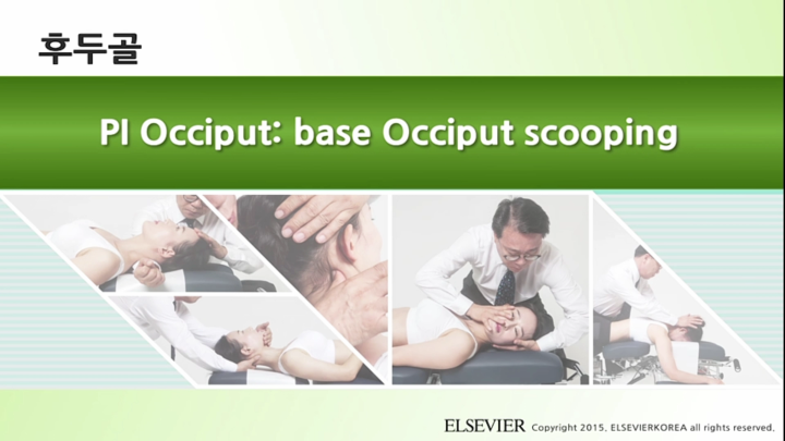 후두골_006 PI Occiput ba<x>se Occiput scooping v1