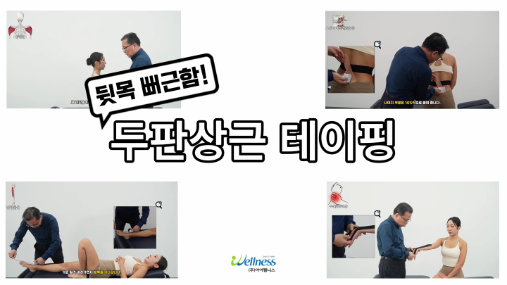 뒷목 뻐근함과 통증! 두판상근 테이핑!
