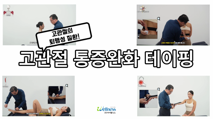 고관절의 퇴행성 질환! 고관절 통증완화 테이핑