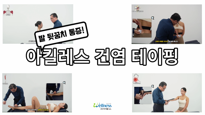 발 뒷꿈치 통증 아킬레스 건염 테이핑