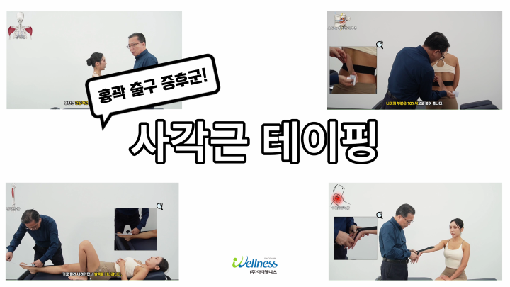 흉곽 출구 증후군 사각근 테이핑 요법