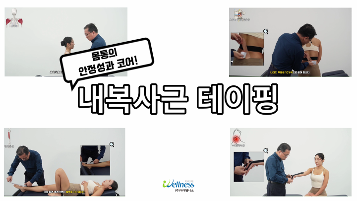 몸통의 안정성과 코어! 내복사근 테이핑