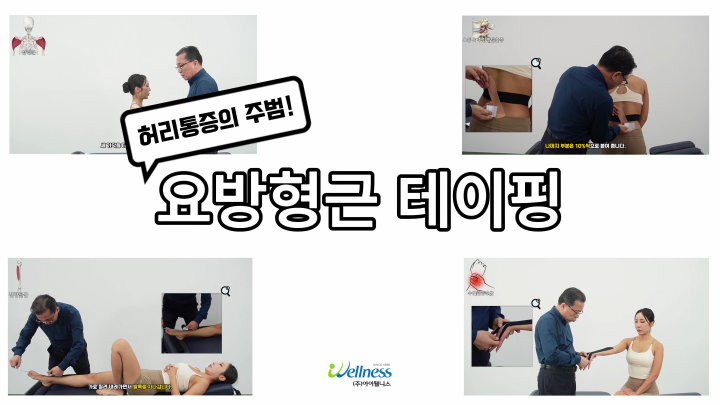 허리통증의 주범 요방형근 테이핑