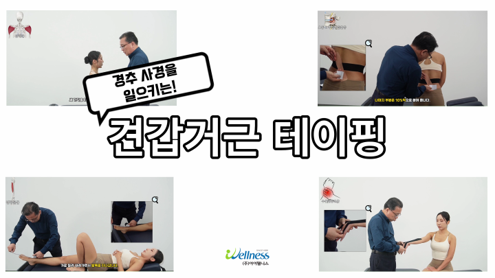 경추 사경을 일으키는 견갑거근 테이핑