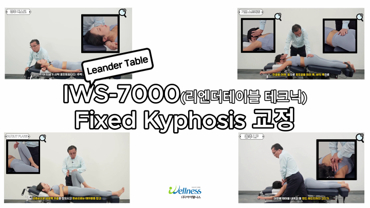 18, 리엔더테이블 테크닉 - fixed kyphosis 교정