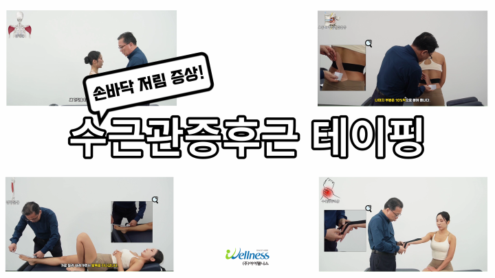 손바닥 저림 증상 수근관증후군_테이핑요법